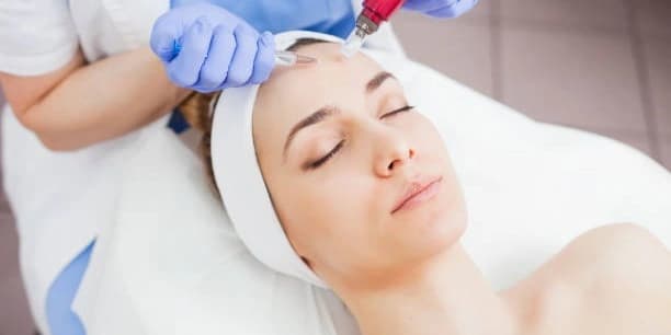 One PRP Facials with Morpheus8 RF Microneedling
