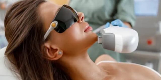 One IPL Photo Facial or Microneedling Session; Purchase Limits Apply