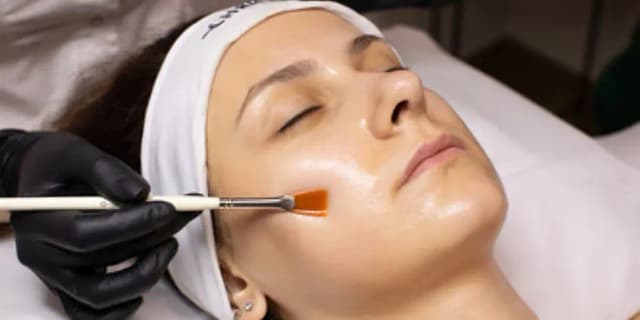 One Chemical Jessner Peel