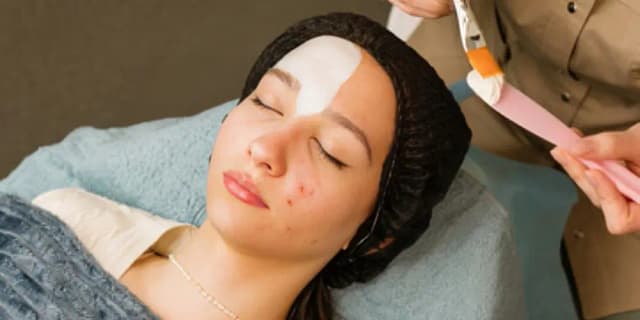 80 Minute Acne Facial