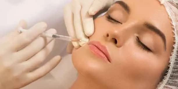 ½ syringe of Juvederm Ultra or Ultra Plus XC