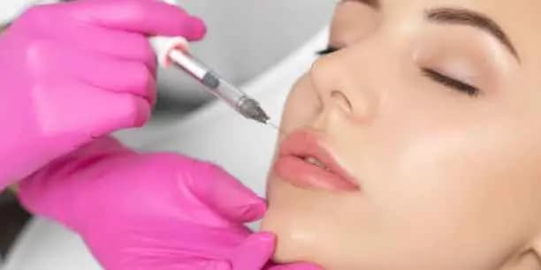 One Syringe of Juvéderm Ultra XC or Ultra Plus XC