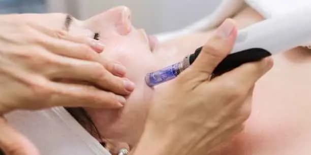 Microneedling with Red Light Therapy