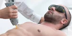 Brazilian Hair Removal - Men