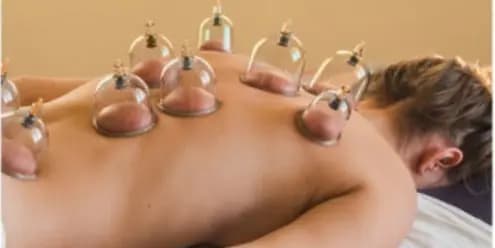 60-Minute Cupping Massage