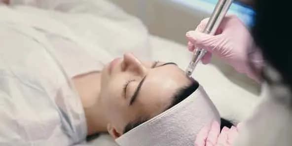 Single Microneedling Treatment