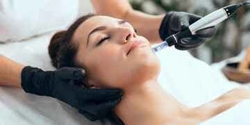 One Microneedling Treatment for New Clients Only; Valid with Tammy