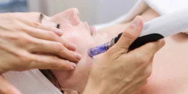 Three Microneedling Treatments for New Clients Only; Valid with Tammy