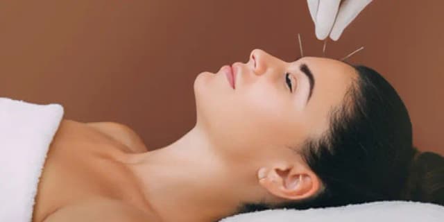 Cosmetic Acupuncture: Natural Facelift