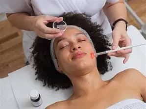 Medical Grade Chemical Peel