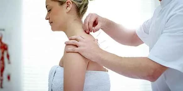 Acupuncture Second Session