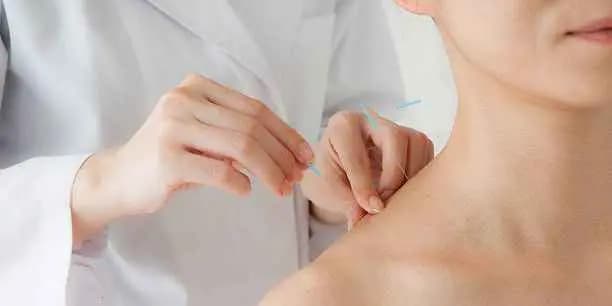 Acupuncture First Session