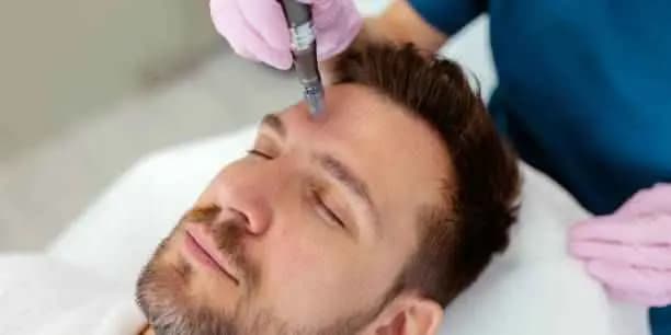 Men's Microneedling Facial