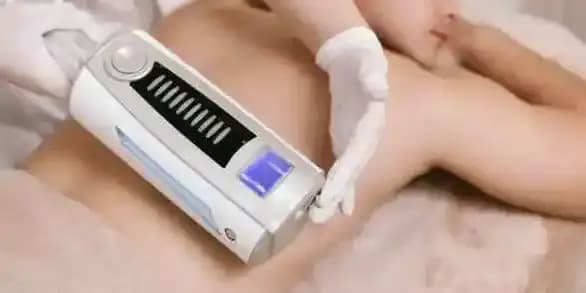 45-Minute Men's Endosphere Treatment (Ten Sessions)