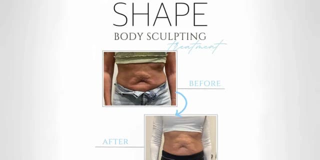 10 Non Surgical Fat Reduction Treatments