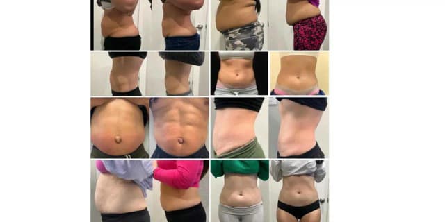 Body Sculpting Consultation