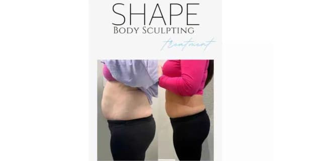 6 Non Surgical Permanent Fat Reduction Treatments