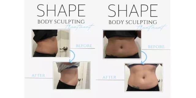 8 Non Surgical Permanent Fat Reduction Treatments