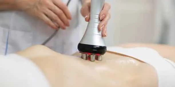 One 60-Minute Session of Radiofrequency Treatment