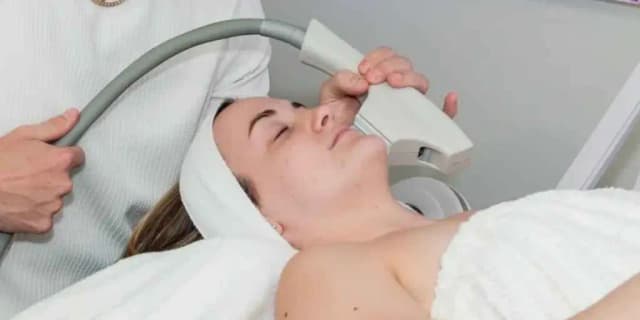 One BBL Photofacial (Valid for New Clients Only)
