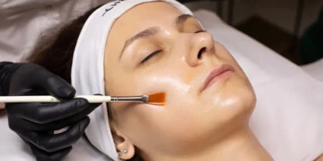 One Glycolic Peel with a Signature Facial