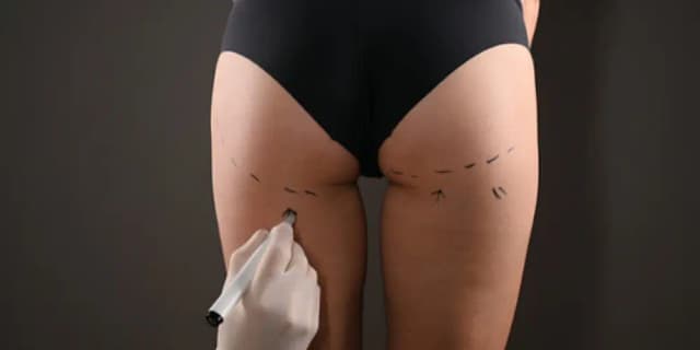 Four Non-Invasive Brazilian Butt Lift and Enlargement Treatments