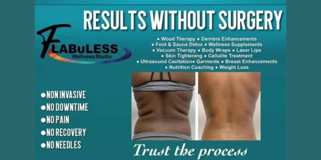 Flabuless 3D Laser Lipo Treatment