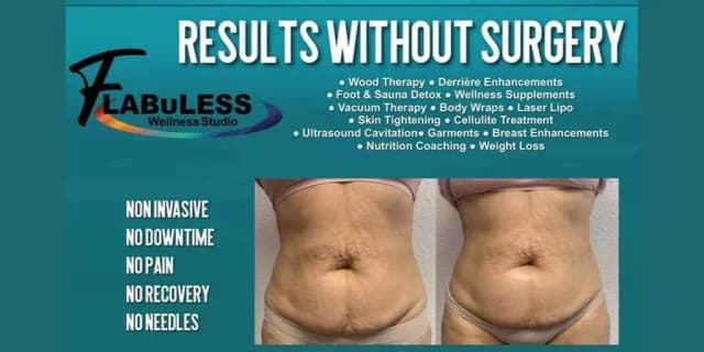 One Fat Dissolve Infusion Treatment (Non-invasive & Needle Free)