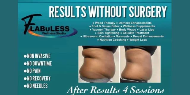 Three Fat Dissolve Infusion Treatments (Non-invasive & Needle Free)