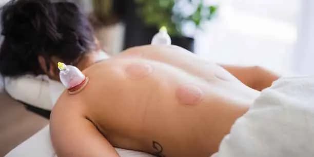 HIJAMA (Wet Cupping) – General Detox