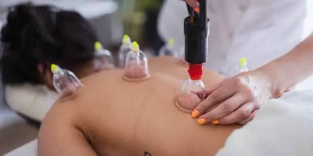 HIJAMA (Wet Cupping) – Deep Detox