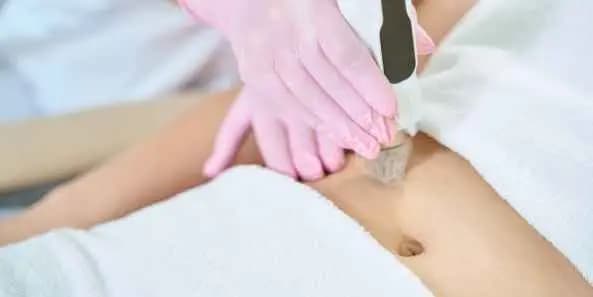 Radio Frequency Microneedling