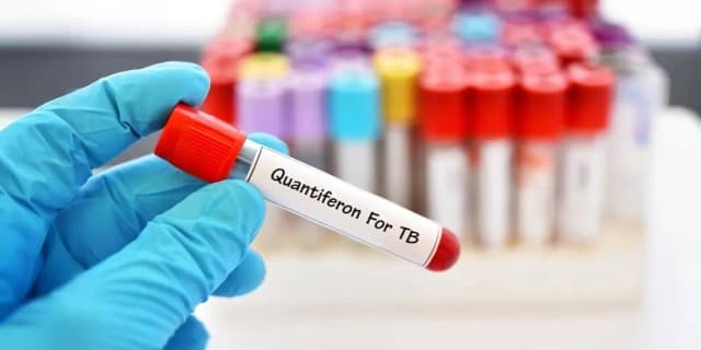 QuantiFERON Gold Plus