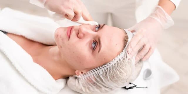 Glow Away Acne Ritual (Acne Treatment Facial)