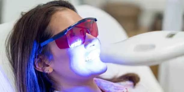 Teeth Whitening (Organic/Professional)