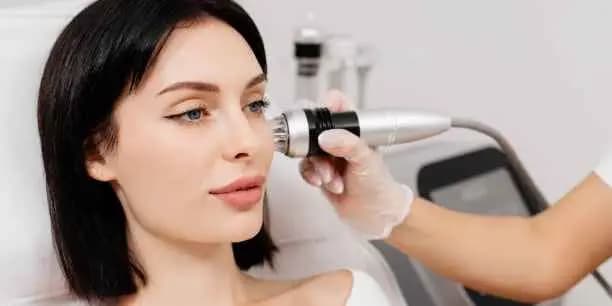 RF Microneedling with Cold Hammer