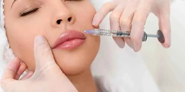 Lip Fillers (RHA)