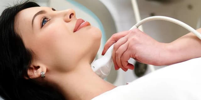 High Intensity Ultrasound Around the Mouth Lift