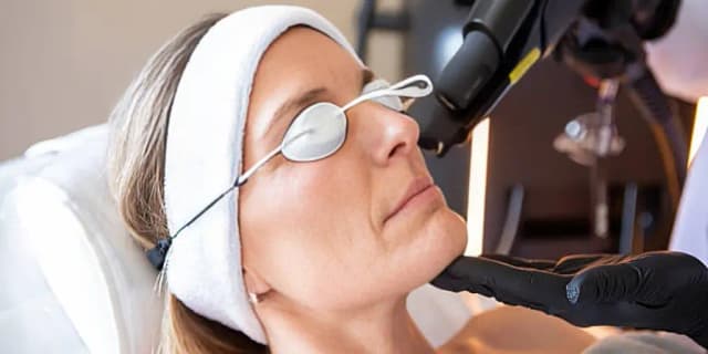 Two Laser Age-Spot Removal Treatments on Two Areas or Two Treatments on One Area