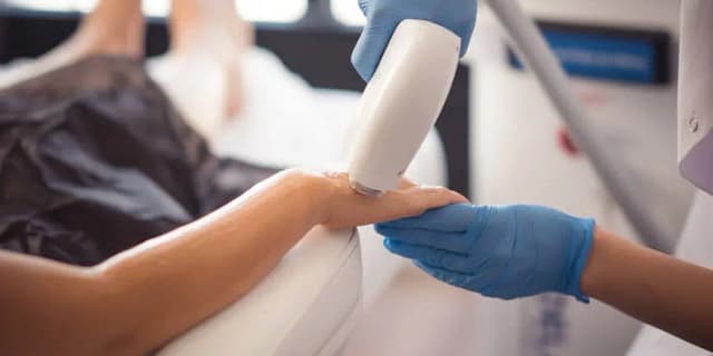 One Laser Hair Removal Session on One Medium Area