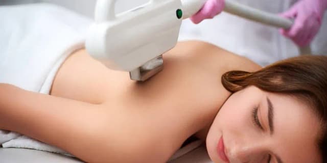 One Laser Hair Removal Session on One Large Area