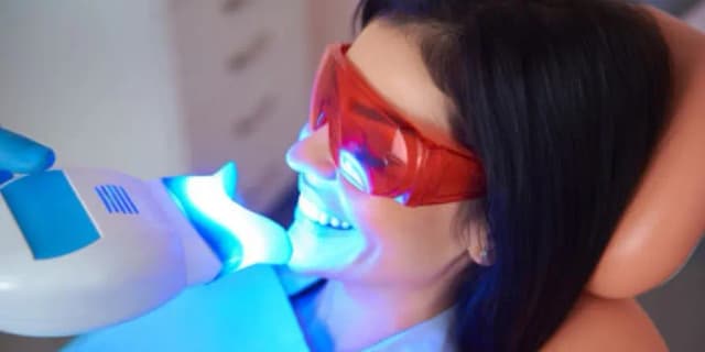 30 Minute Teeth Whitening Session