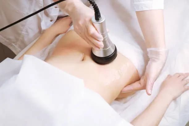 One Radio-Frequency Skin-Tightening Treatment
