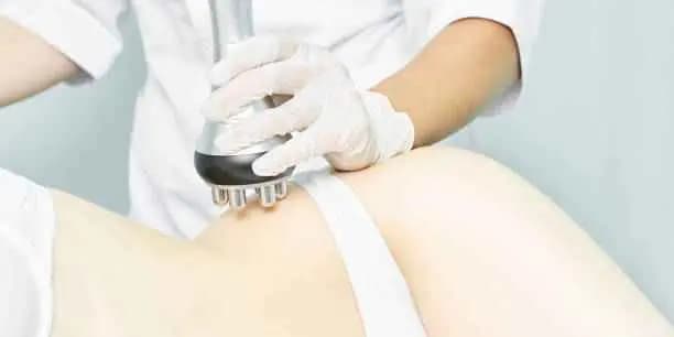 Two Radio-Frequency Skin-Tightening Treatments