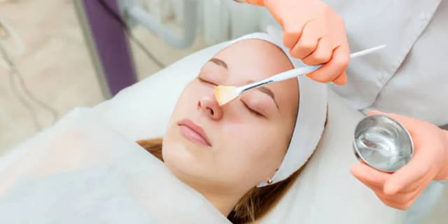 One Chemical Peel with Microdermabrasion