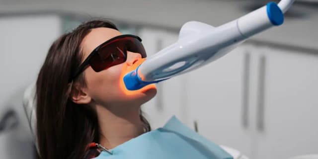 Three Teeth Whitening Treatments