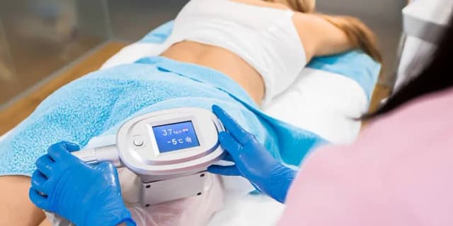 Three 50-Minute Cryolipolysis Fat Freezing Treatments