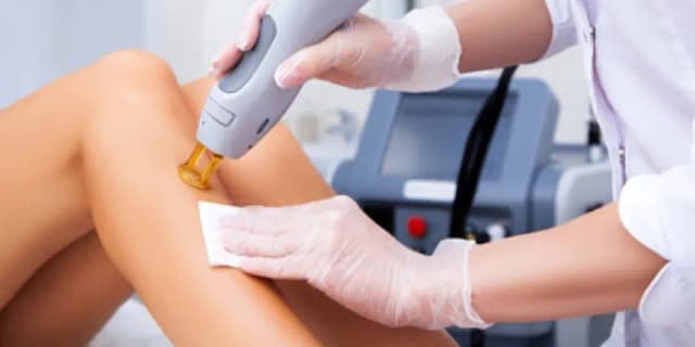 Laser Hair Removal - Large Area
