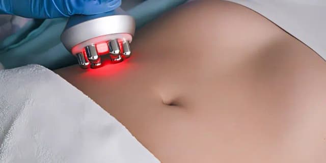 Red Light for Abdomen Contouring (12 Treatments)
