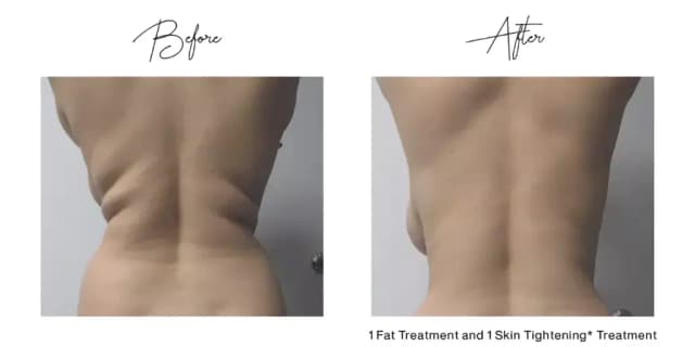 Slim & Sculpt: One 60 Minute Session Body Contour Treatment